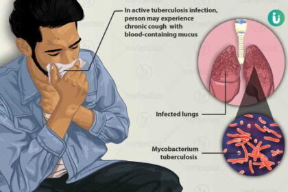 kshayrog 100 days tuberculosis campaign started : जिल्ह्यात आजपासून 100 दिवसीय क्षयरोग मोहीमेस सुरुवात -NNL