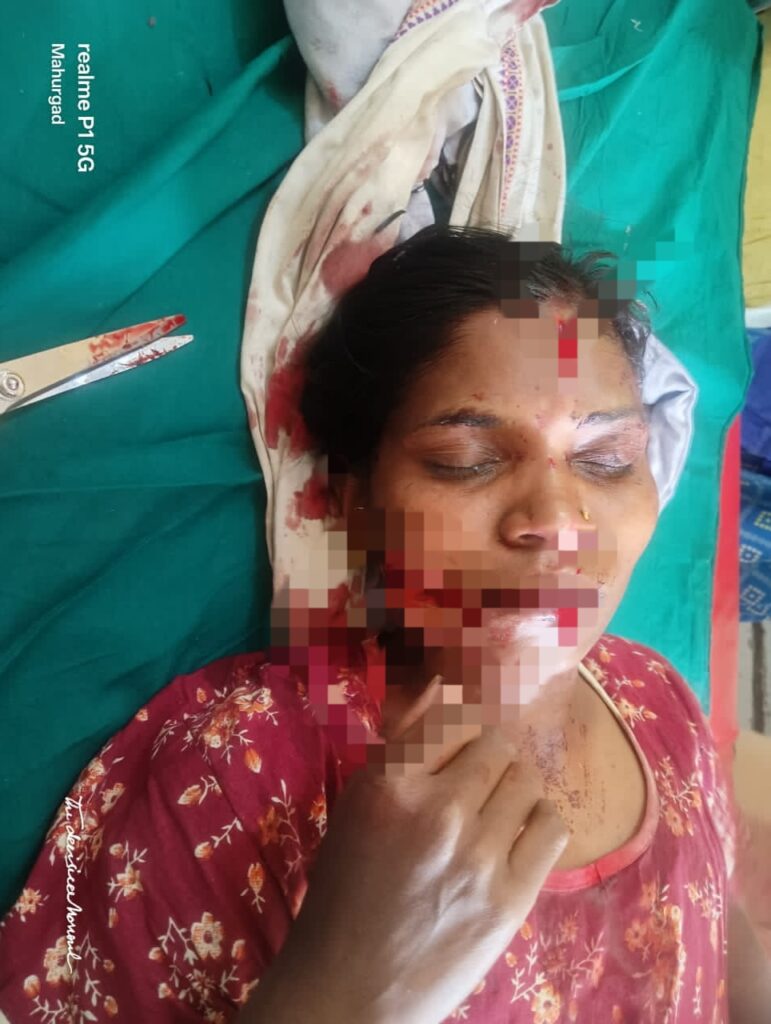 attacked by wild animal : शेतात काम करणाऱ्या महिलेवर वन्य प्राण्याचा हल्ला; महिला गंभीर जखमी